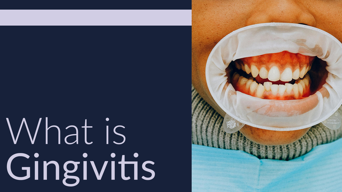 What is Gingivitis?